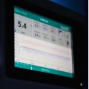 VISION 400 ECT-F TOUCH